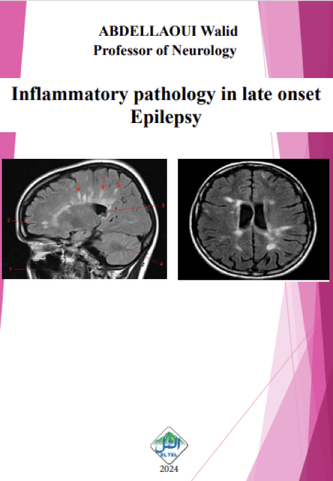 Inflammatory pathology in late onset Epilepsy