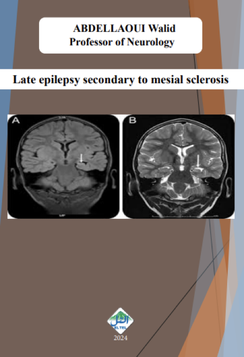 Late epilepsy secondary to mesial sclerosis