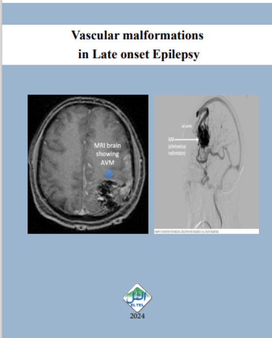 Alcoholism and late onset epilepsy