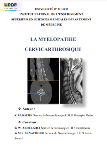 LA MYELOPATHIE CERVICARTHROSIQUE